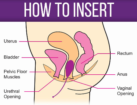 how to insert kegel balls